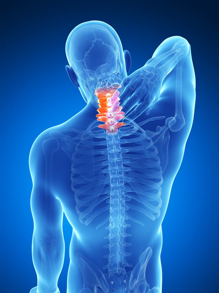 váll és nyakfájdalom a térd osteoarthritisének kezelése